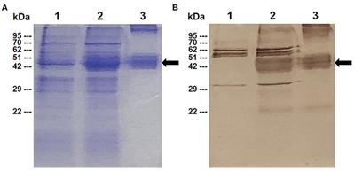 Immunization of Cattle With Recombinant Structural Ectodomains I and II of Babesia bovis Apical Membrane Antigen 1 [BbAMA-1(I/II)] Induces Strong Th1 Immune Response